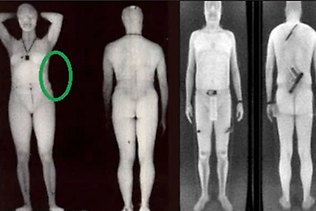 Body scanner blind spot